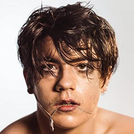 Declan McKenna- What Do You Think About The Car? (Clear/Yellow Vinyl)